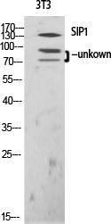 Western blot analysis of various cells using Anti-ZEB2 Antibody