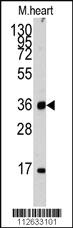 Anti-ULK3 Rabbit Polyclonal Antibody