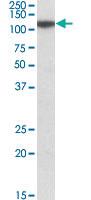 Anti-MTHFD1L Goat Polyclonal Antibody