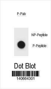 Anti-IKBKB Rabbit Polyclonal Antibody (PE (Phycoerythrin))