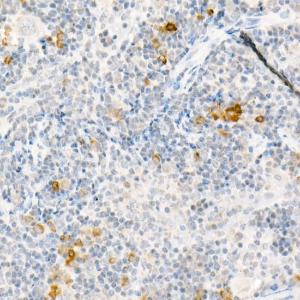 Anti-MCP1 antibody