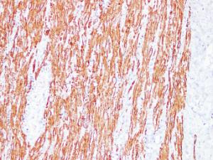 Immunohistochemical analysis of paraffin-embedded human Appendix using Anti-Desmin Antibody