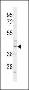 Anti-CEBPA Rabbit Polyclonal Antibody (HRP (Horseradish Peroxidase))