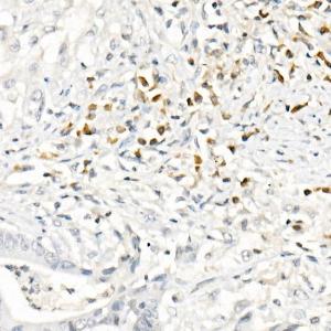 Anti-MCP1 antibody