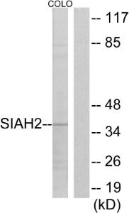 Anti-Siah2 Rabbit Polyclonal Antibody