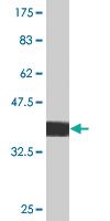 Anti-TOPORS Mouse Monoclonal Antibody [clone: 6C8]