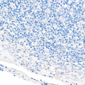 Immunohistochemistry analysis of paraffin-embedded human tonsil (negative control sample) using Anti-CDX2 Antibody [ARC0450] (A308015) at a dilution of 1:300 (40X lens). Perform microwave antigen retrieval with 10 mM PBS buffer pH 7.2 before commencing with IHC staining protocol