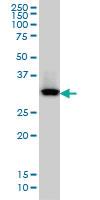 Anti-QPRT Mouse Monoclonal Antibody [clone: 5D11]