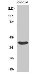 Anti-Siah2 Rabbit Polyclonal Antibody