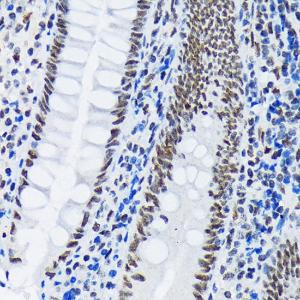 Immunohistochemistry analysis of paraffin-embedded human appendix tissue using Anti-PIAS1 + PIAS2 Antibody [ARC1690] (A305609) at a dilution of 1:100 (40x lens)