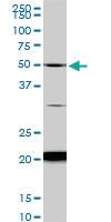 Anti-NADK Mouse Monoclonal Antibody [clone: 5F4]