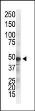 Anti-IKBKG Mouse Monoclonal Antibody (APC (Allophycocyanin)) [clone: 55AT986.5.78]