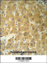 Anti-Prealbumin Rabbit Polyclonal Antibody (APC (Allophycocyanin))