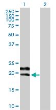 Anti-GYPC Mouse Polyclonal Antibody