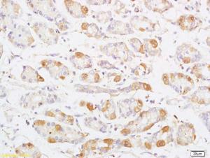 Anti-MAP3K8 Rabbit Polyclonal Antibody