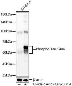 Western blot analysis of SH-SY5Y, using Anti-Tau (phospho Ser404) Antibody [ARC58154] (A309488) at 1:5,000 dilution