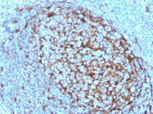 Immunohistochemical analysis of formalin-fixed, paraffin-embedded human tonsil using Anti-Cystatin A Antibody [CSTA/3553]