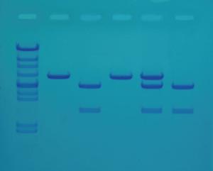 Kit Ready-to-Load™, diagnostic du cholestérol