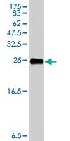 Anti-OXCT1 Mouse Polyclonal Antibody