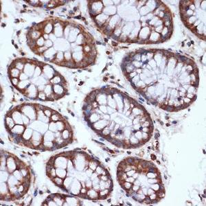 Immunohistochemistry analysis of paraffin-embedded human colon tissue using Anti-HSPA14 Antibody [ARC1908] (A306797) at a dilution of 1:100 (40X lens). Perform microwave antigen retrieval with 10 mM Tris/EDTA buffer pH 9.0 before commencing with IHC staining protocol