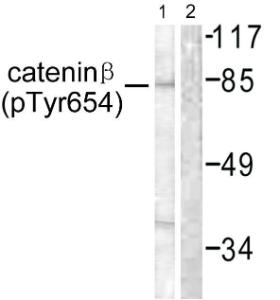 Western blot analysis of lysates from 293 cells using Anti-Catenin-beta (phospho Tyr654) Antibody. The right hand lane represents a negative control, where the Antibody is blocked by the immunising peptide