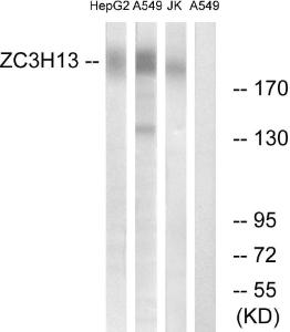 Anti-ZC3H13 antibody