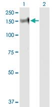 Anti-PHKA2 Rabbit Polyclonal Antibody