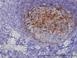 Anti-QPRT Mouse Monoclonal Antibody [clone: 5D11]