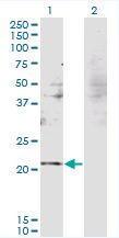 Anti-RBM8A Mouse Monoclonal Antibody [clone: 3E4]