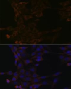 Immunofluorescence analysis of NIH-3T3 cells using Anti-HSPA14 Antibody [ARC1908] (A306797) at a dilution of 1:100 (40X lens). DAPI was used to stain the cell nuclei (blue)