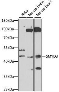 Western blot analysis of extracts of various cell lines, using Anti-SMYD3 Antibody (A12102) at 1:1000 dilution