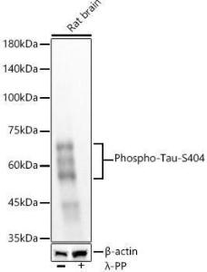 Western blot analysis of various lysates, using Anti-Tau (phospho Ser404) Antibody [ARC58154] (A309488) at 1:5,000 dilution