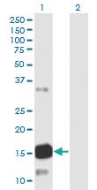 Anti-ATXN7L1 Mouse Monoclonal Antibody [clone: 1H2]