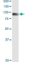 Anti-ASXL2 Polyclonal Antibody Pair