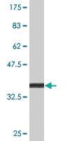 Anti-TOPORS Mouse Monoclonal Antibody [clone: 6F11]