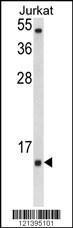 Anti-SOD1 Rabbit Polyclonal Antibody (Biotin)