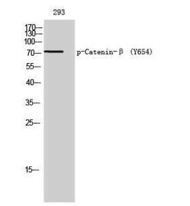 Western blot analysis of 293 cells using Anti-Catenin-beta (phospho Tyr654) Antibody