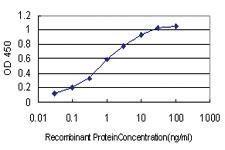 Anti-QPRT Mouse Monoclonal Antibody [clone: 5D11]