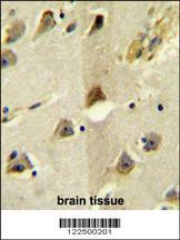 Anti-SLC12A5 Rabbit Polyclonal Antibody (AP (Alkaline Phosphatase))