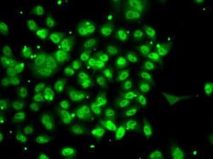 Immunofluorescence analysis of A-549 cells using Anti-SMYD3 Antibody (A12102)