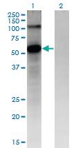 Anti-FZD4 Mouse Monoclonal Antibody [clone: 3G7]