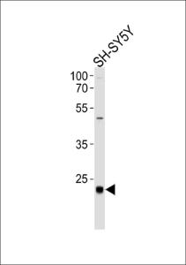 Anti-CEBPD Rabbit Polyclonal Antibody (APC (Allophycocyanin))