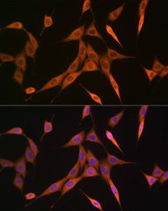 Immunofluorescence analysis of NIH-3T3 cells using Anti-RhoA + RhoB + RhoC Antibody [ARC0273] (A306798) at a dilution of 1:100 (40X lens). DAPI was used to stain the cell nuclei (blue)