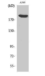 Anti-ZC3H13 antibody