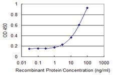 Anti-ATXN7L1 Mouse Monoclonal Antibody [clone: 1H2]