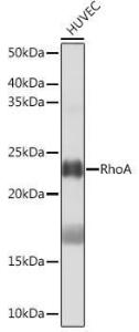 Western blot analysis of extracts of HUVEC cells, using Anti-RhoA Antibody [ARC0372] (A306799) at 1:1,000 dilution. The secondary antibody was Goat Anti-Rabbit IgG H&L Antibody (HRP) at 1:10,000 dilution.