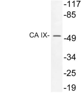 Western blot analysis of lysate from 293 cells treated with insulin using Anti-CA IX Antibody