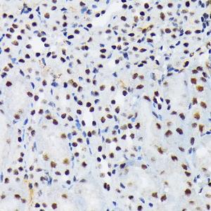 Immunohistochemistry analysis of paraffin-embedded mouse kidney using Anti-PIAS1 + PIAS2 Antibody [ARC1690] (A305609) at a dilution of 1:100 (40x lens)