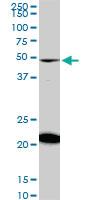 Anti-NADK Mouse Monoclonal Antibody [clone: 5F4]