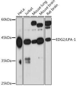 Western blot analysis of extracts of various cell lines, using Anti-EDG2 / LPA-1 Antibody [ARC2224] (A306800) at 1:1,000 dilution. The secondary antibody was Goat Anti-Rabbit IgG H&L Antibody (HRP) at 1:10,000 dilution.